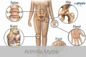 arthritis myths 300x200 1