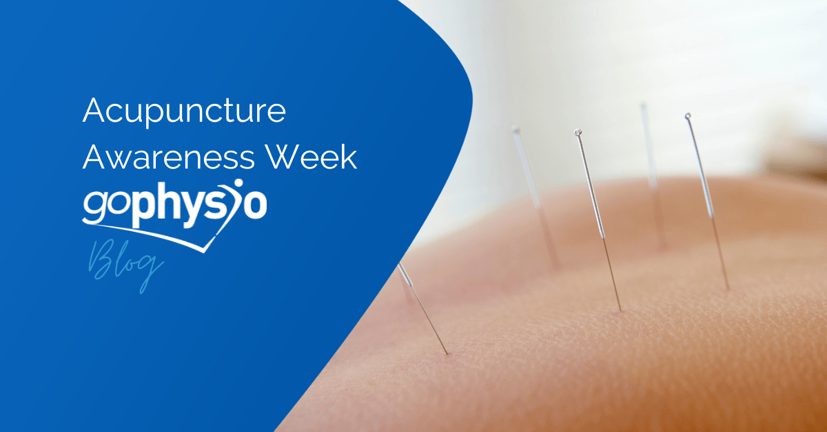 Acupuncture Awareness Week Getting To The Point Go Physio