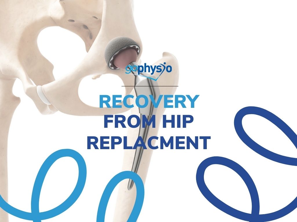 Recovery from total hip replacement surgery